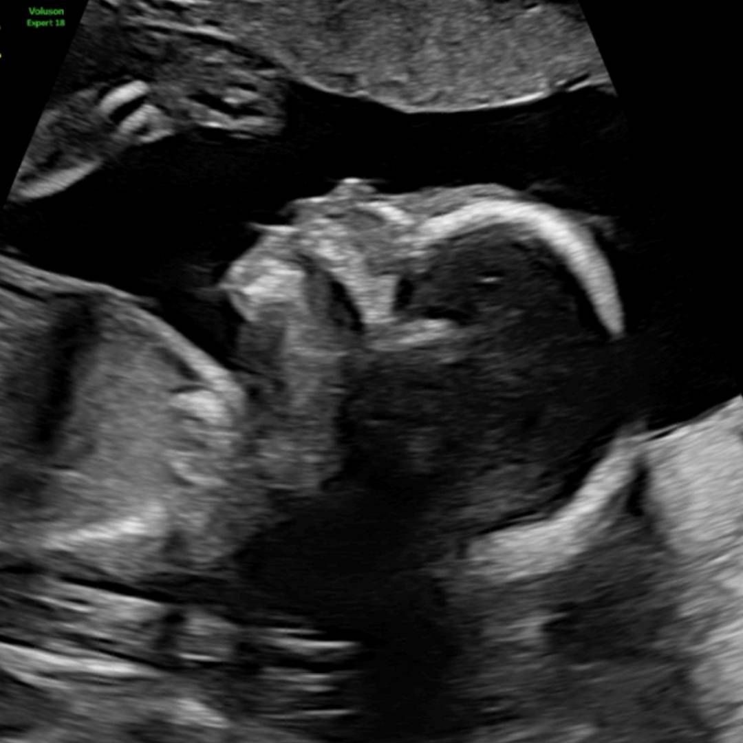 Photo shared by Kaylie for their Babylist baby registry.