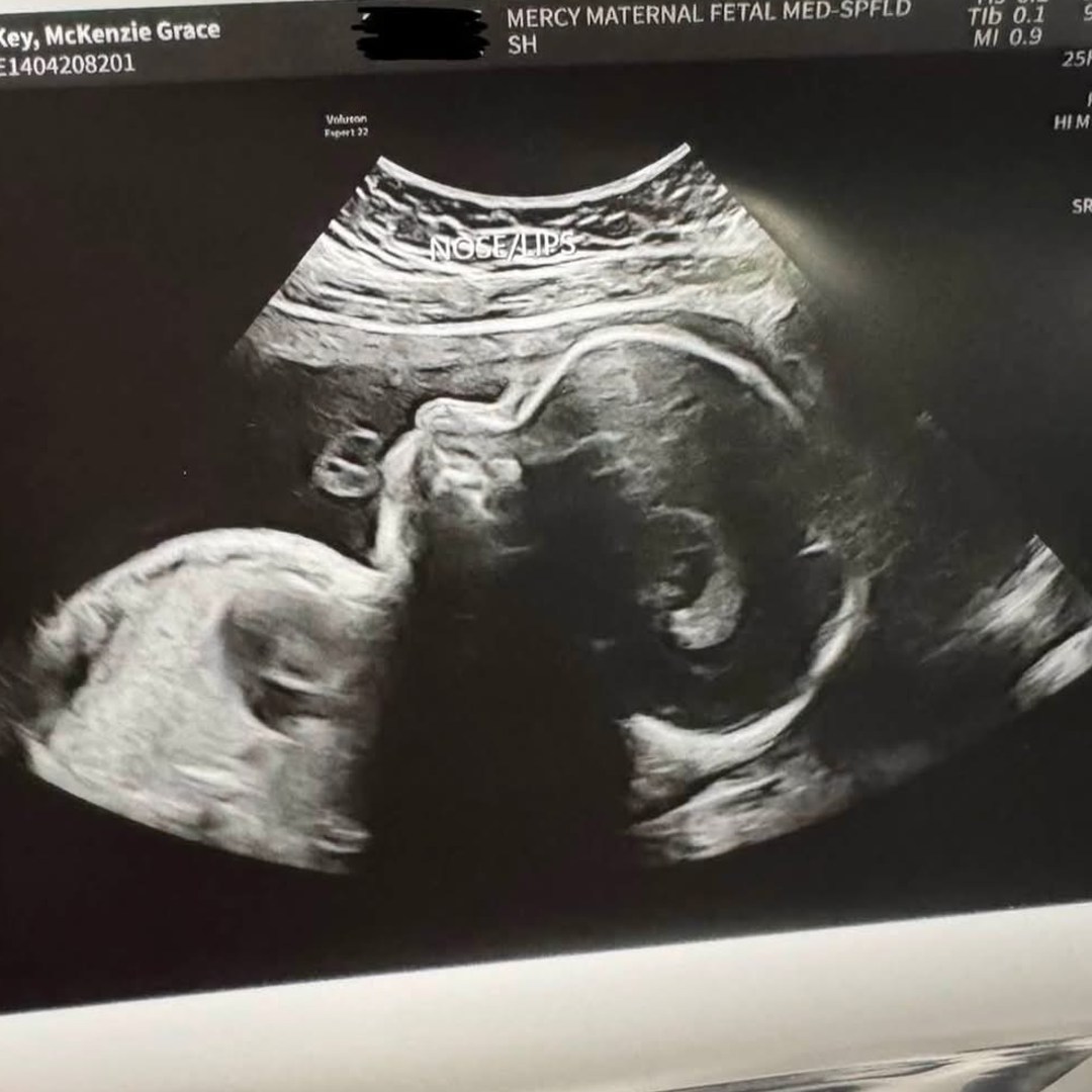 Photo shared by McKenzie for their Babylist baby registry.