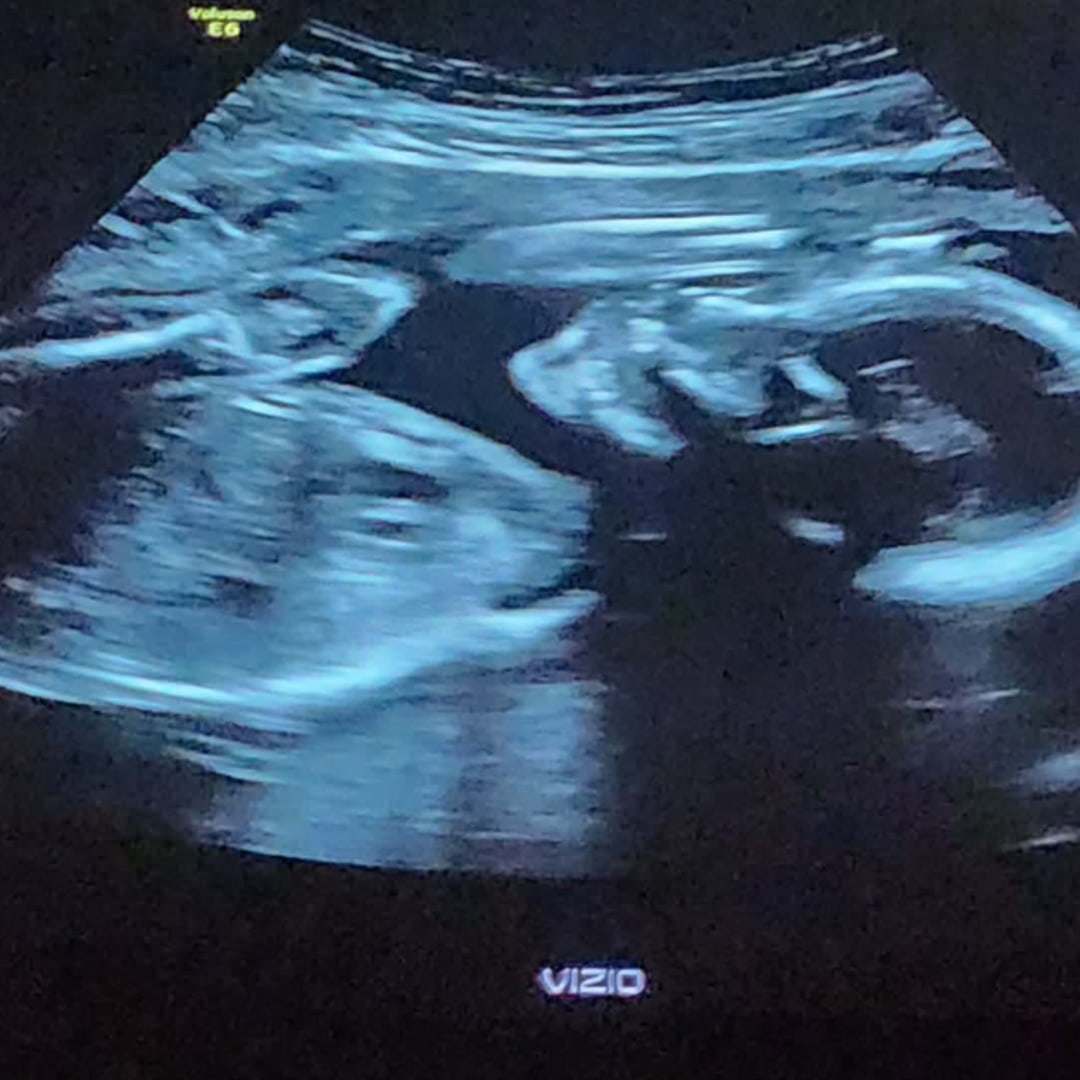 Photo shared by Tess for their Babylist baby registry.