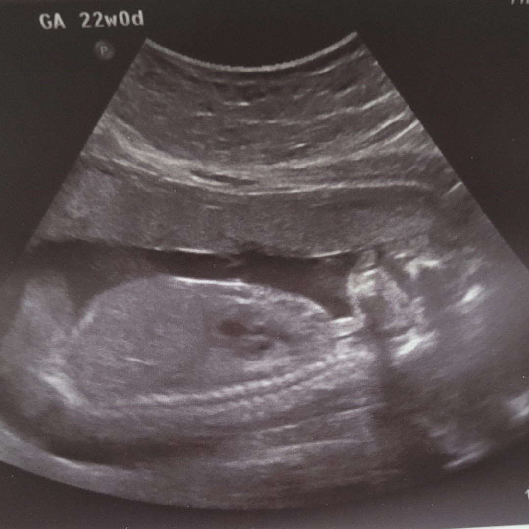 Photo shared by Lucy for their Babylist baby registry.
