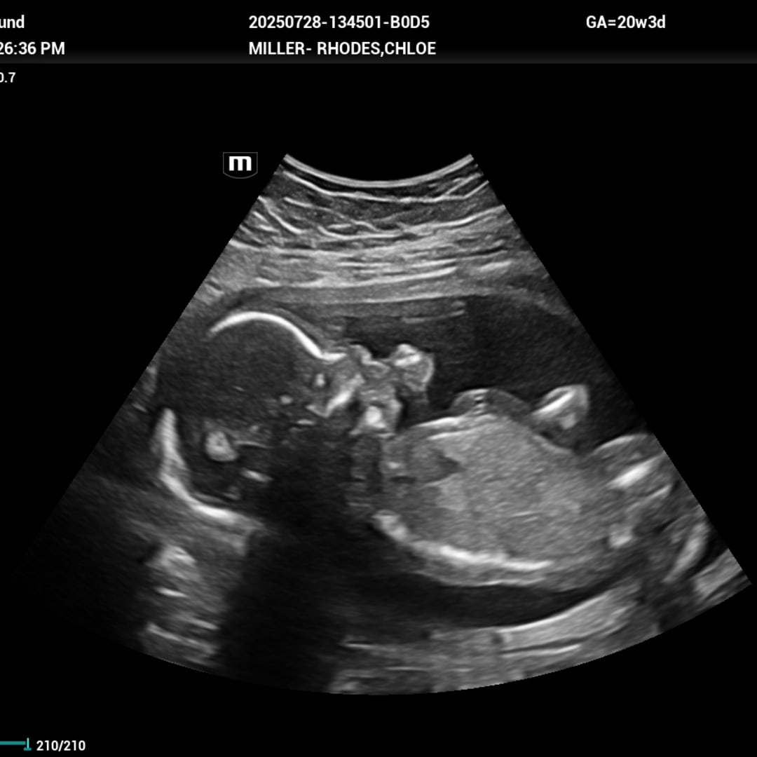 Photo shared by Chloe for their Babylist baby registry.