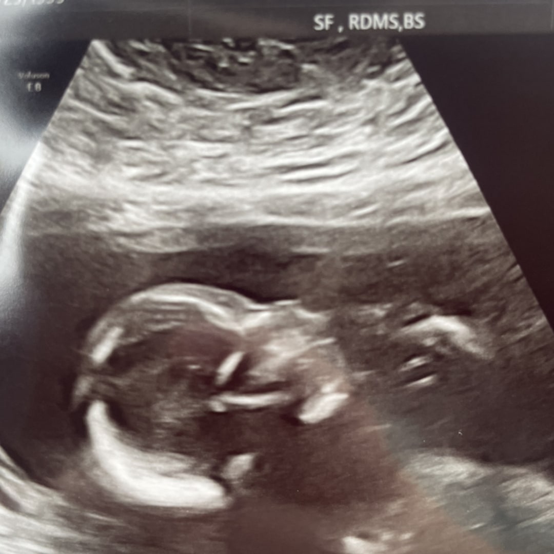 Photo shared by BreAuna for their Babylist baby registry.