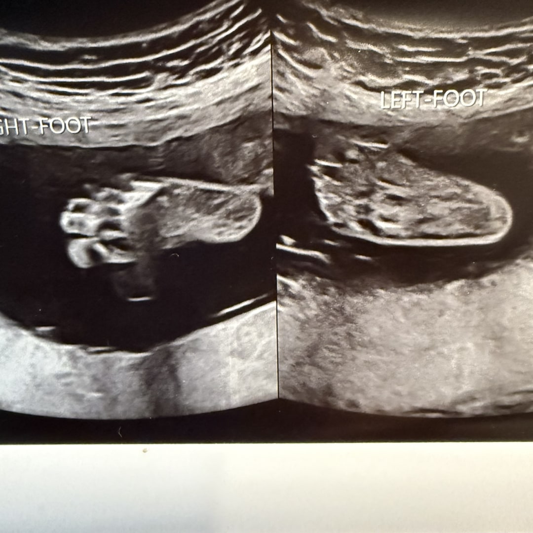 Photo shared by Courtney for their Babylist baby registry.