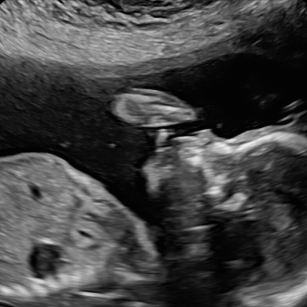 Photo shared by Julian for their Babylist baby registry.
