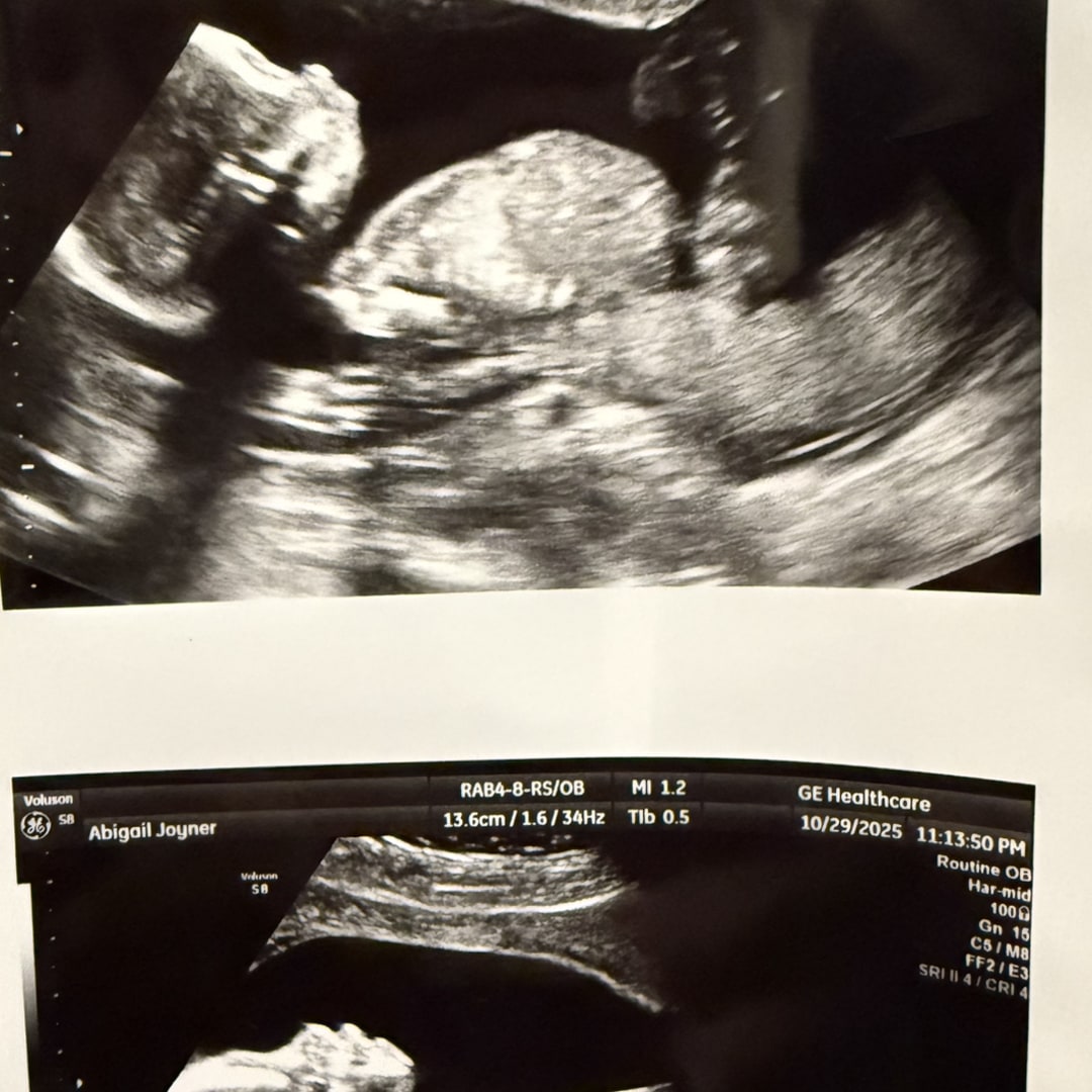 Photo shared by Abigail for their Babylist baby registry.