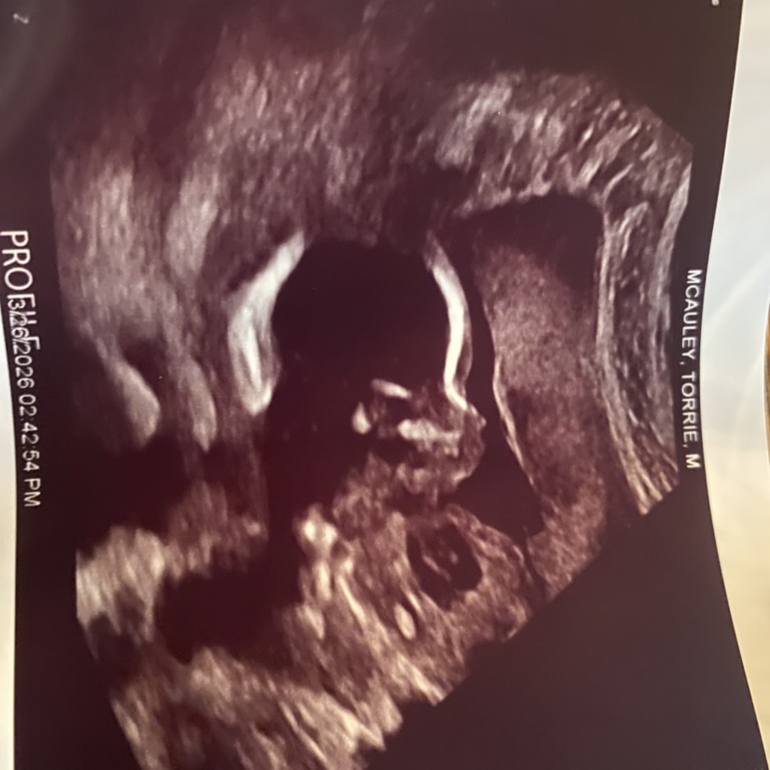 Photo shared by Onyx for their Babylist baby registry.