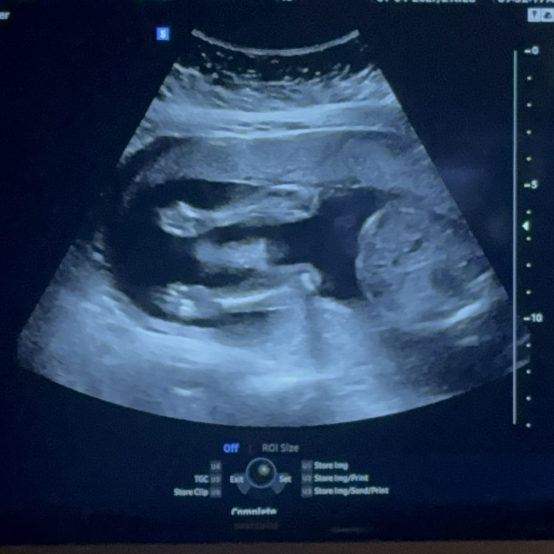 Photo shared by Cathryn for their Babylist baby registry.