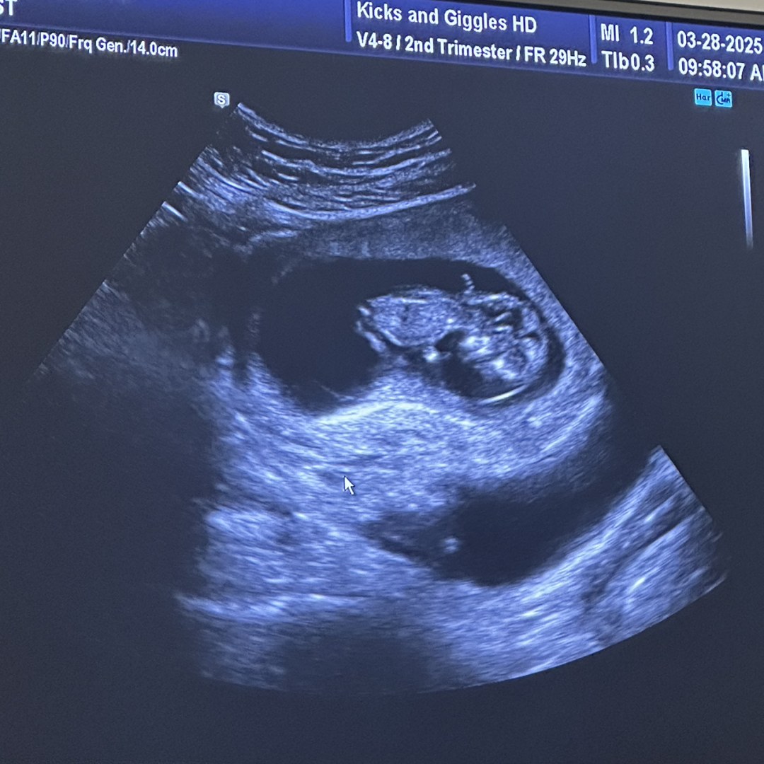 Photo shared by Aden for their Babylist baby registry.