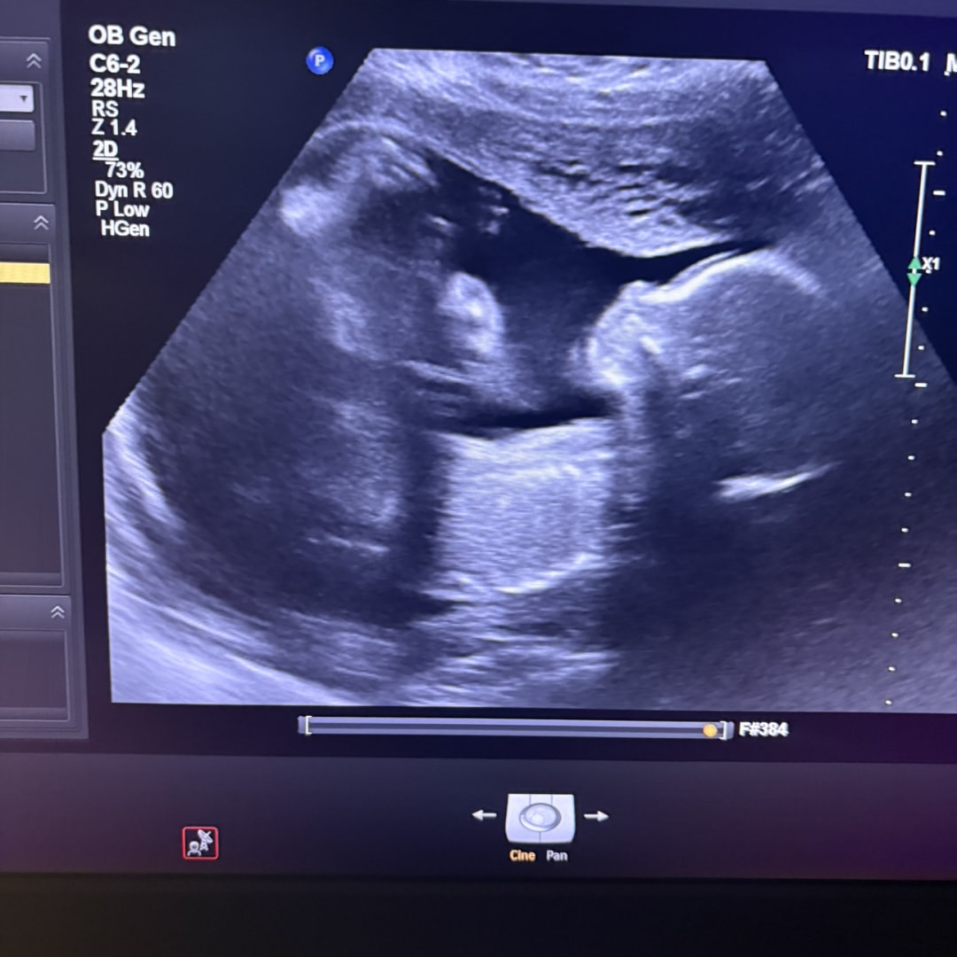 Photo shared by Andrea for their Babylist baby registry.