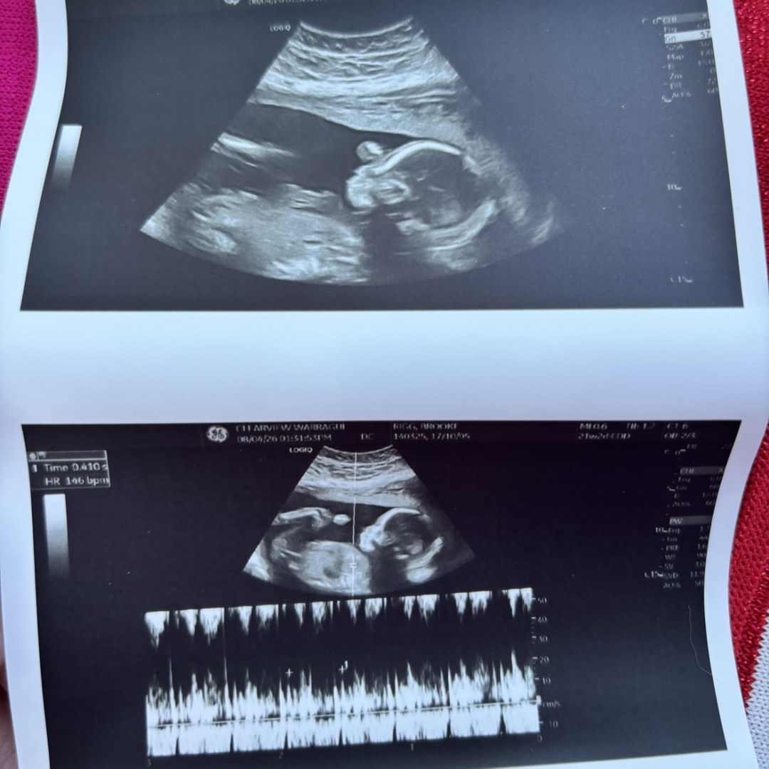 Photo shared by Brooke for their Babylist baby registry.