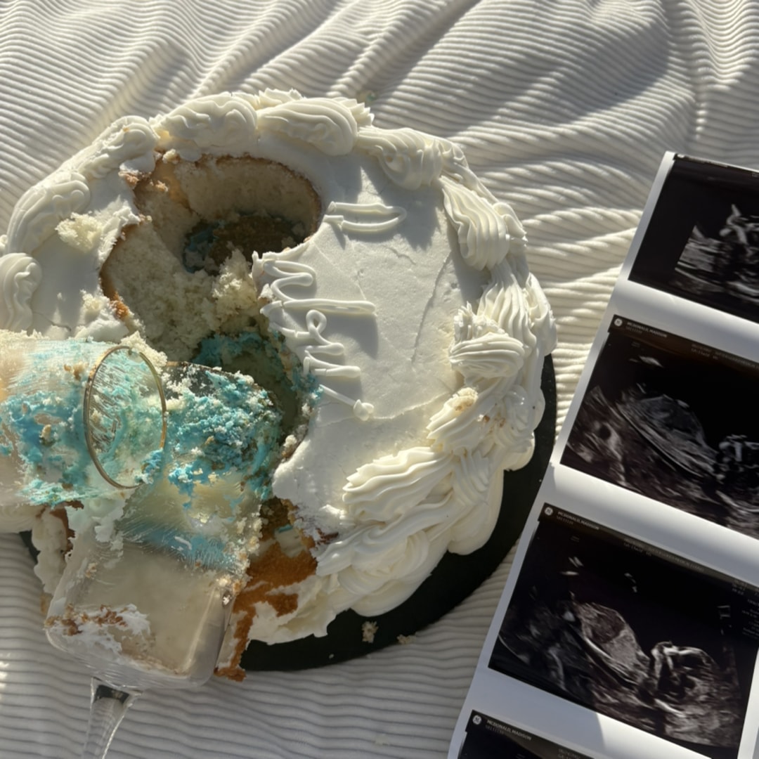 Photo shared by Madison for their Babylist baby registry.