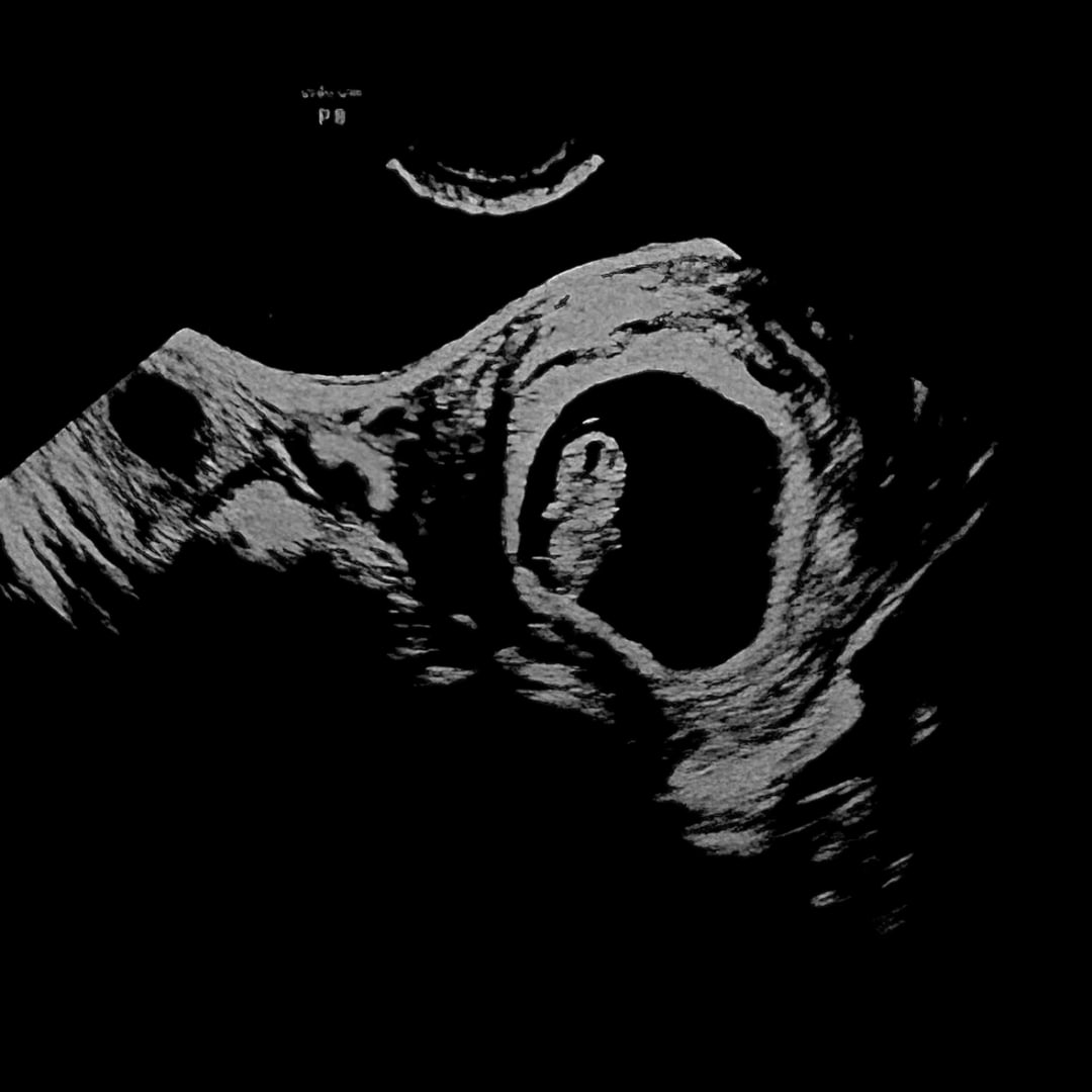 Photo shared by Tara for their Babylist baby registry.