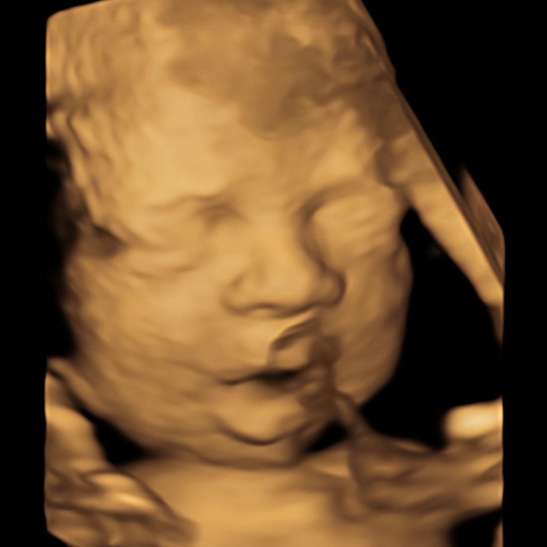 Photo shared by Maggie for their Babylist baby registry.