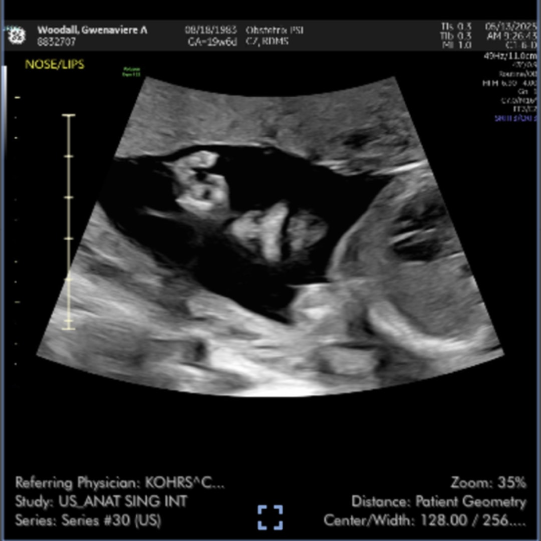 Photo shared by Gwenn for their Babylist baby registry.