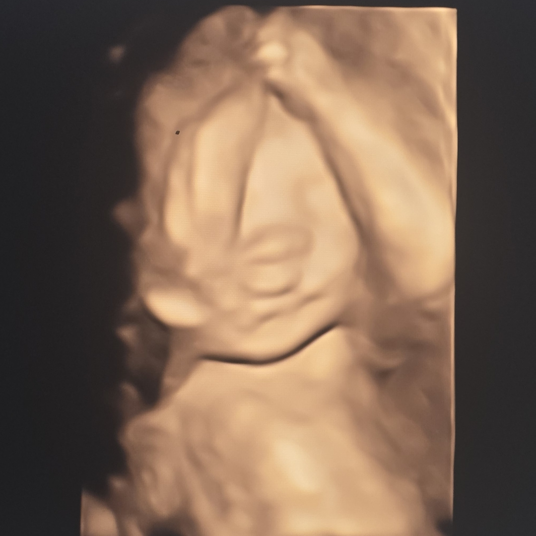 Photo shared by Harley for their Babylist baby registry.