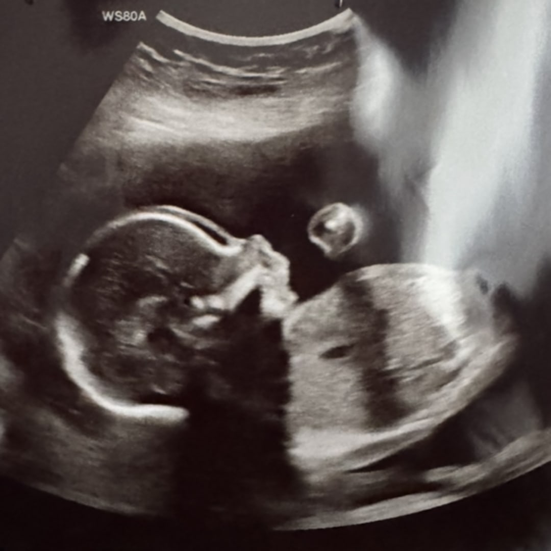 Photo shared by Cortney for their Babylist baby registry.