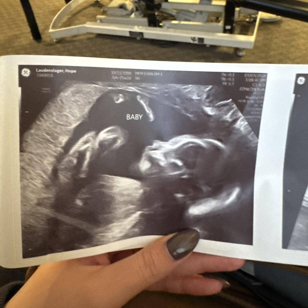 Photo shared by Hope for their Babylist baby registry.