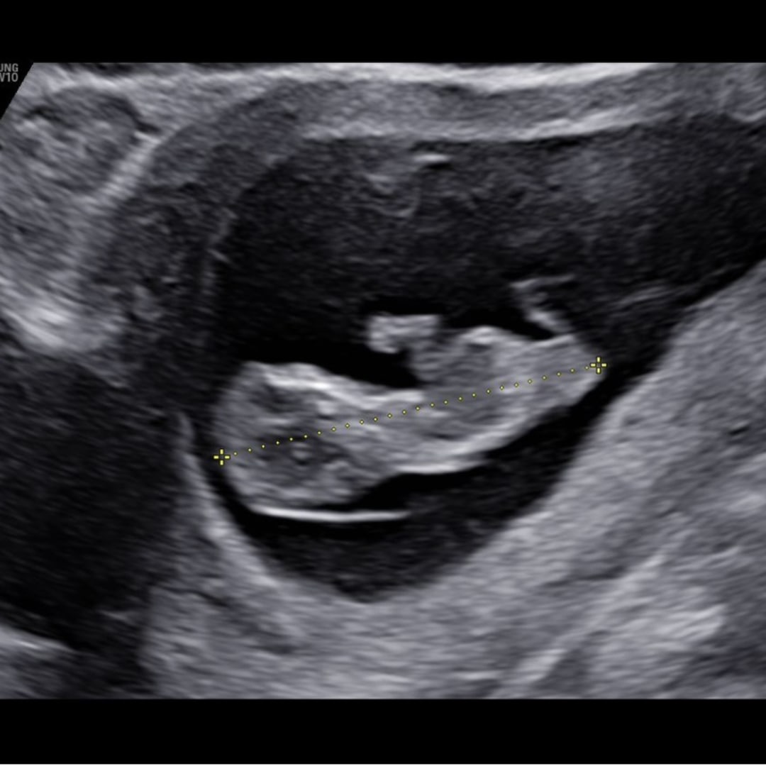 Photo shared by Harley for their Babylist baby registry.