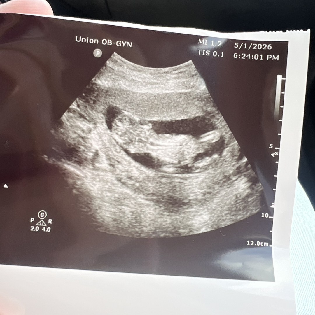 Photo shared by Jesyca for their Babylist baby registry.