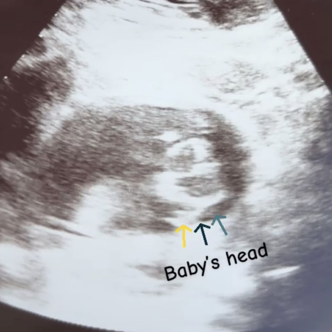 Photo shared by Karla for their Babylist baby registry.