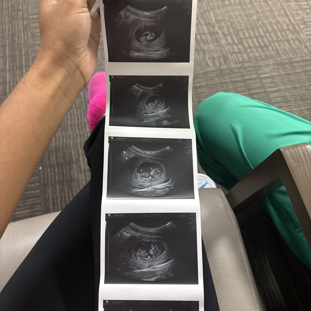 Photo shared by Imani for their Babylist baby registry.