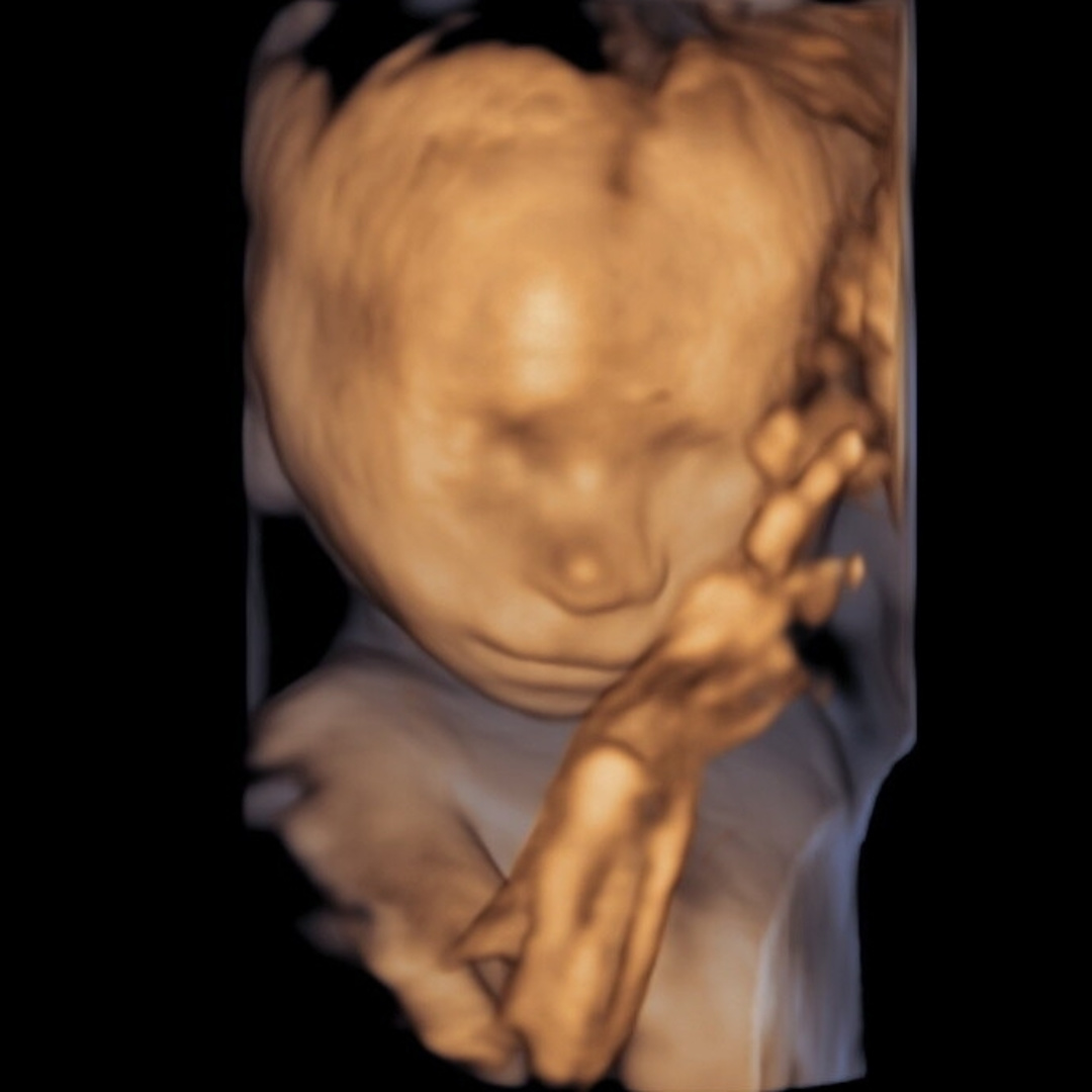 Photo shared by Shanna for their Babylist baby registry.