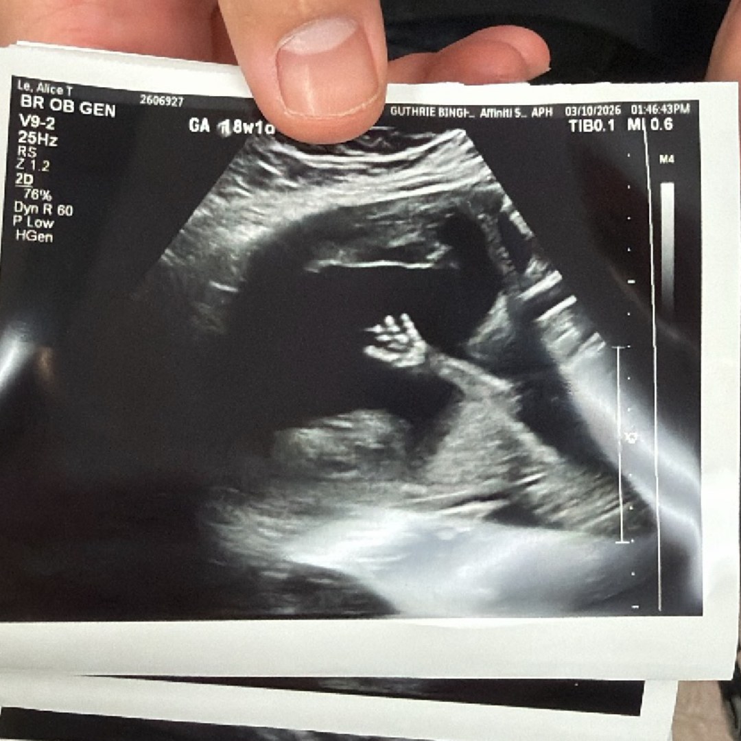 Photo shared by Alice for their Babylist baby registry.