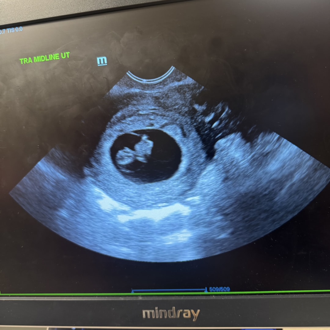 Photo shared by Paige for their Babylist baby registry.