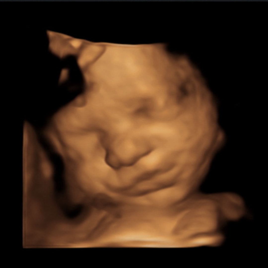 Photo shared by Ashton for their Babylist baby registry.