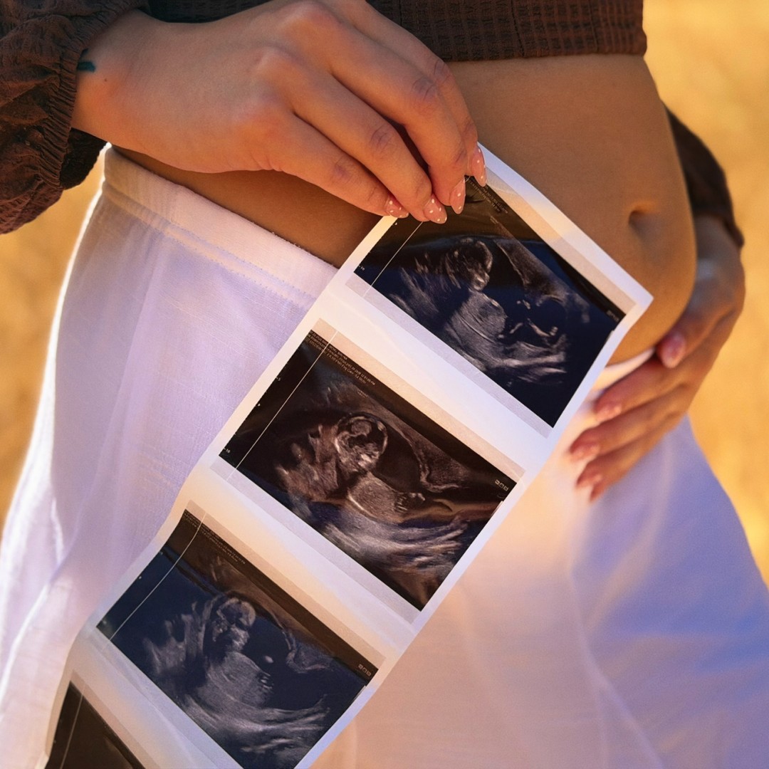 Photo shared by Malina for their Babylist baby registry.