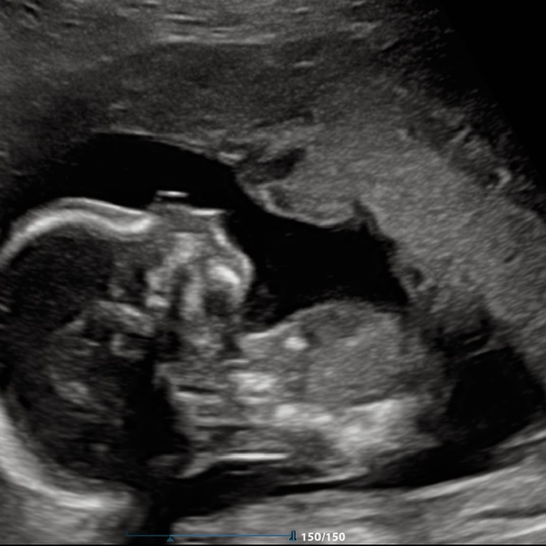 Photo shared by MaKenzie for their Babylist baby registry.