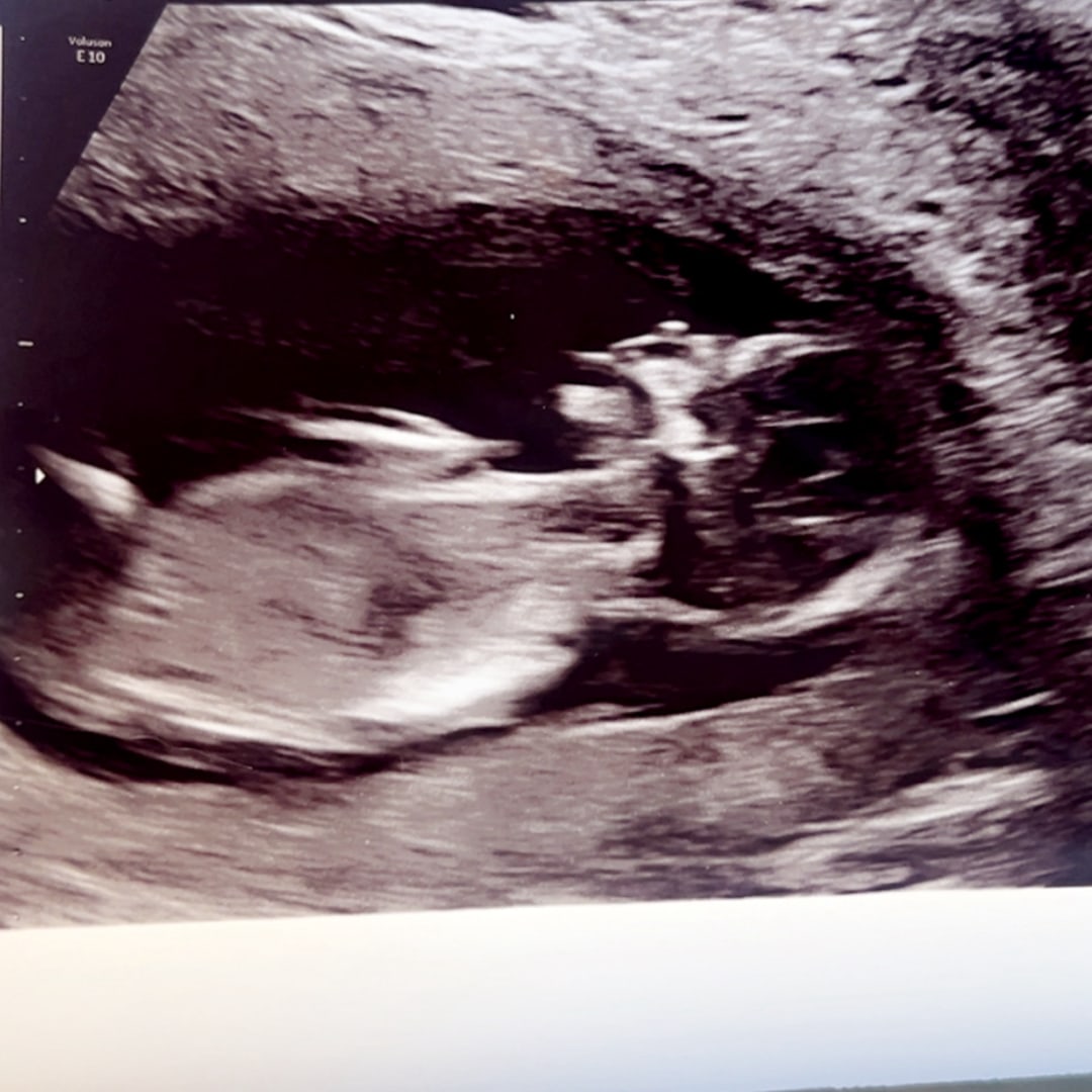 Photo shared by Lindsey for their Babylist baby registry.