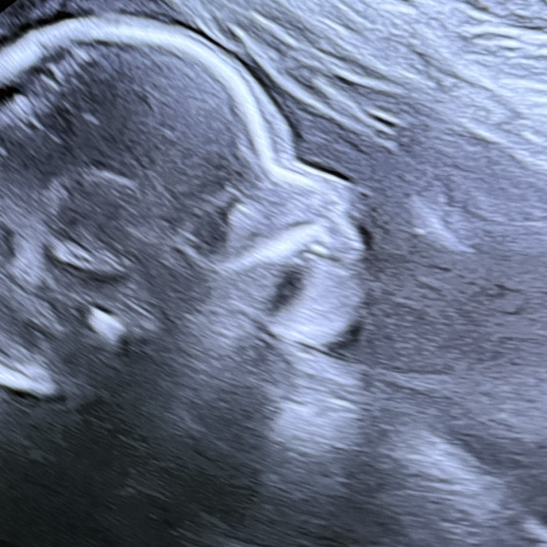 Photo shared by Chaunte for their Babylist baby registry.