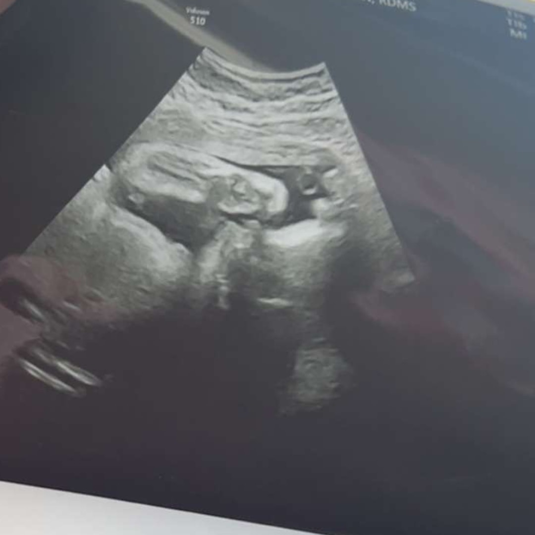 Photo shared by Maya for their Babylist baby registry.