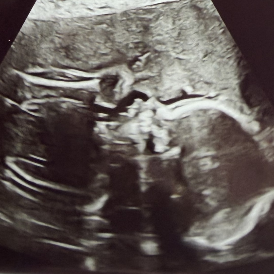 Photo shared by Ashley for their Babylist baby registry.