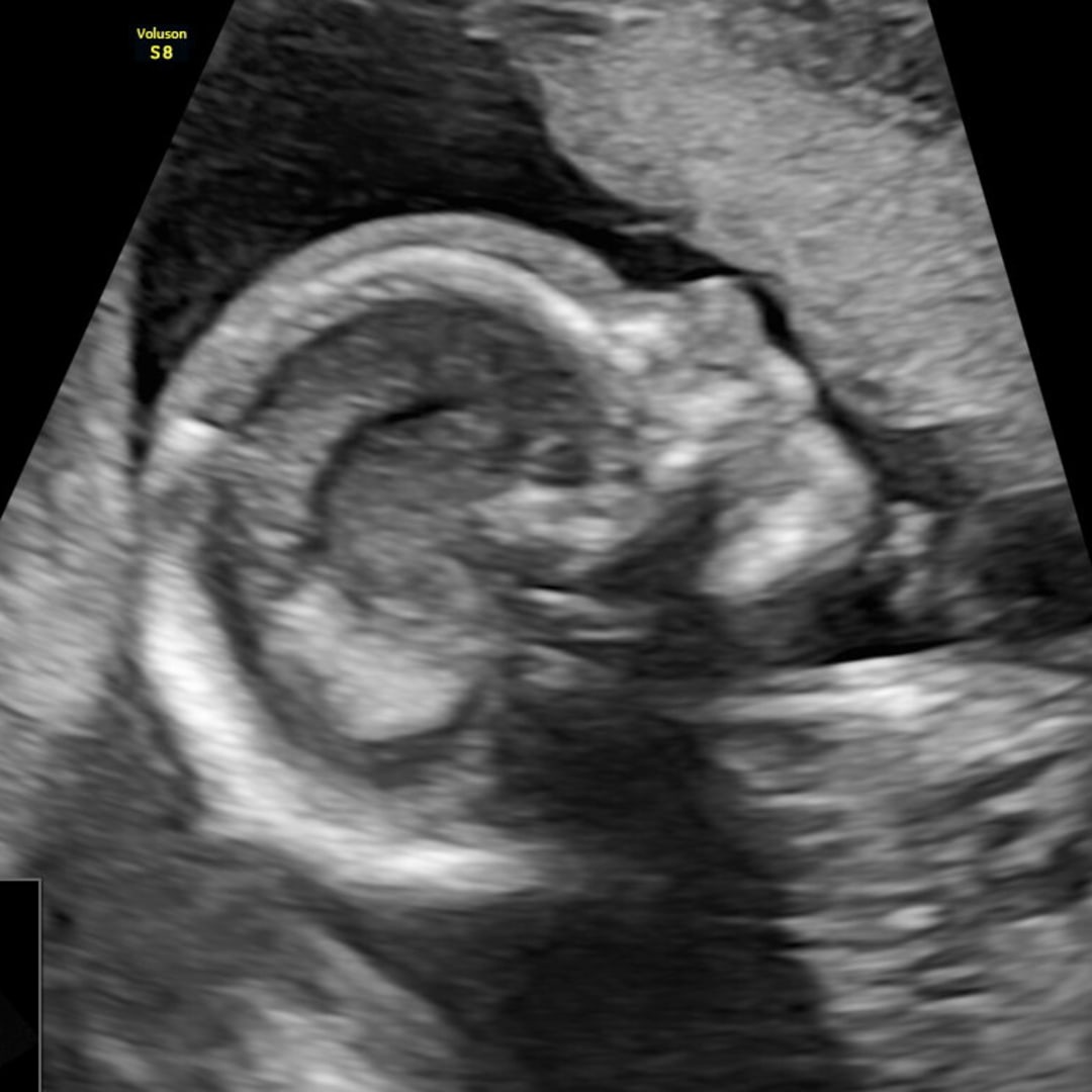 Photo shared by Sally for their Babylist baby registry.