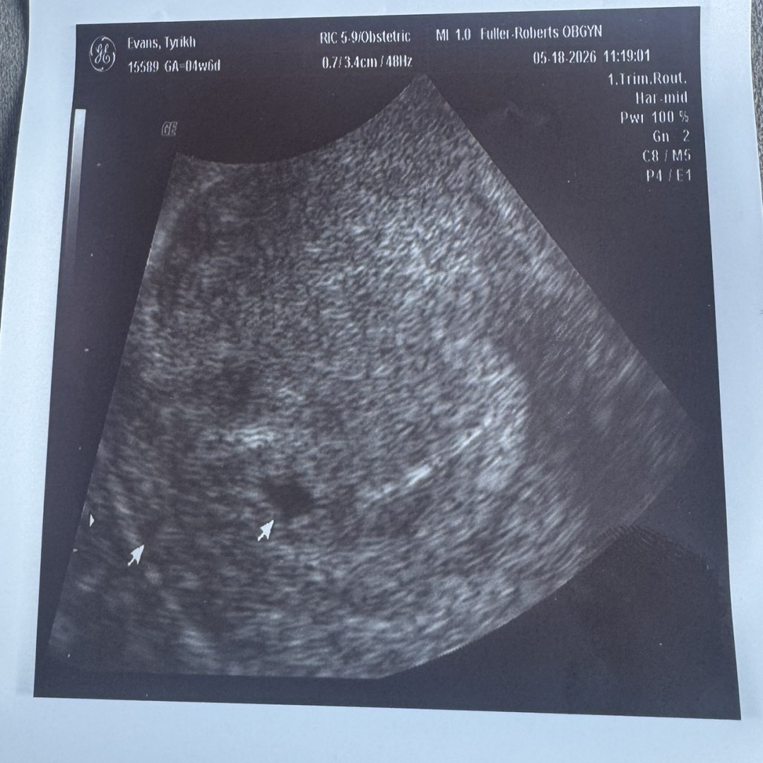 Photo shared by Danni for their Babylist baby registry.