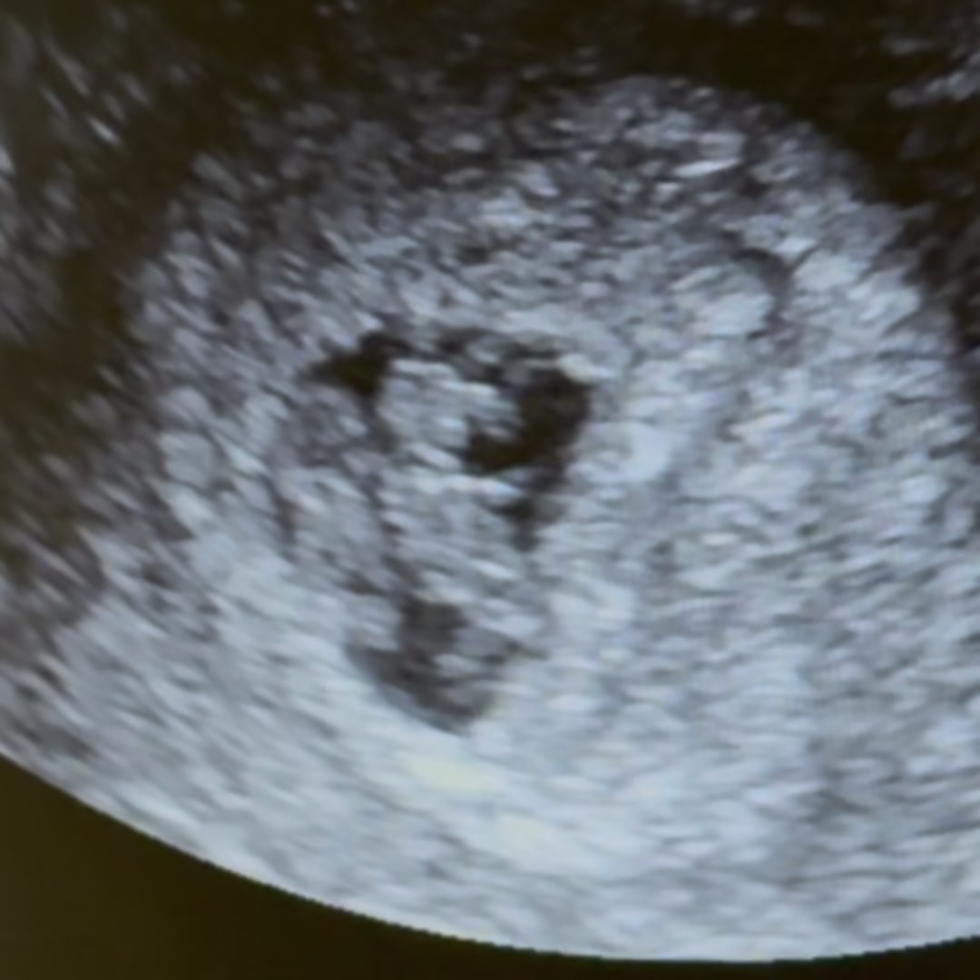 Photo shared by Brandy for their Babylist baby registry.