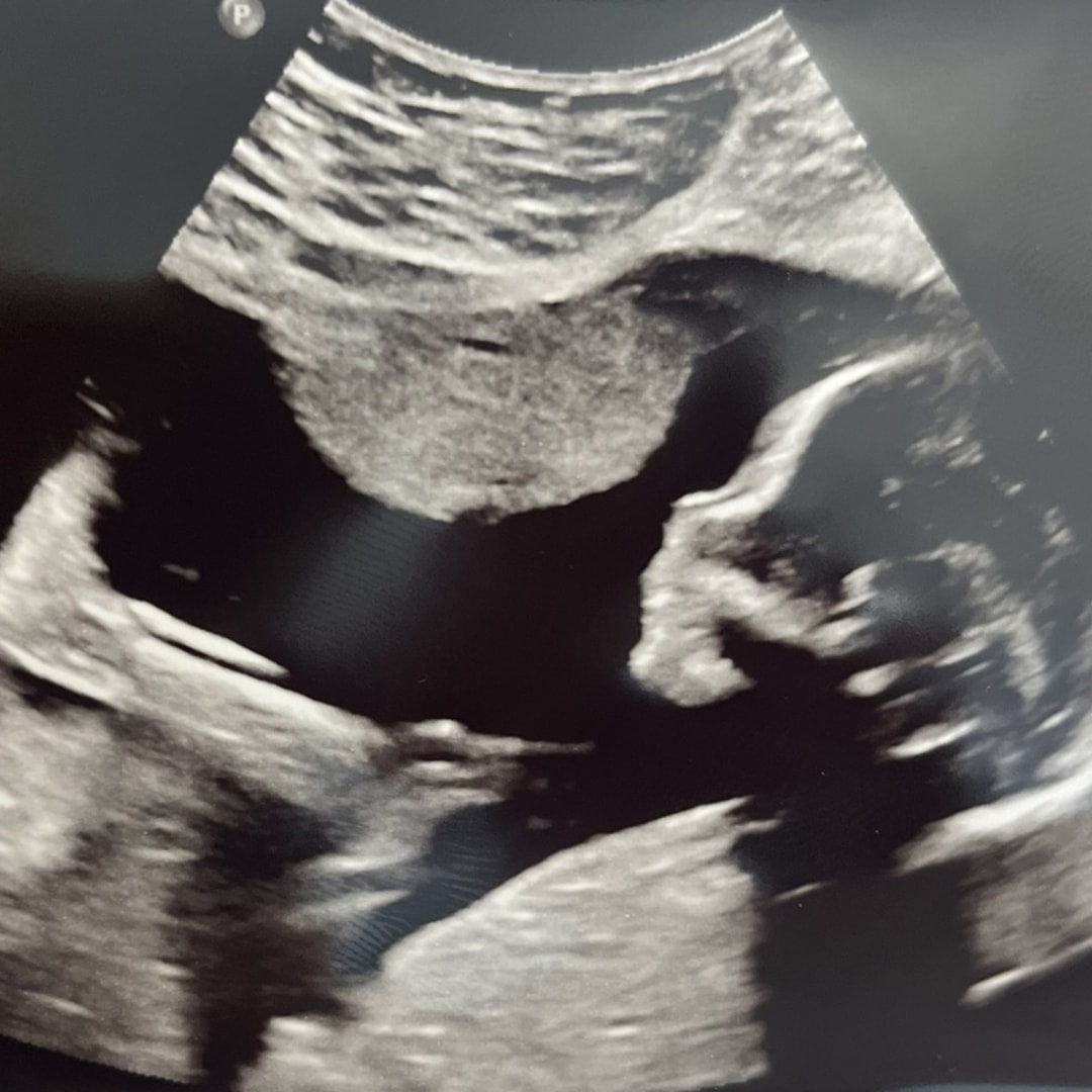 Photo shared by Jennifer for their Babylist baby registry.