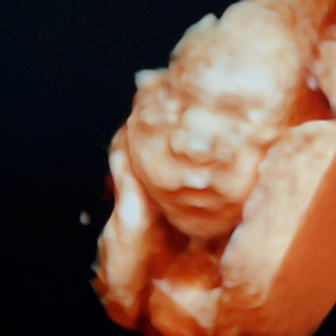 Photo shared by Kelly for their Babylist baby registry.