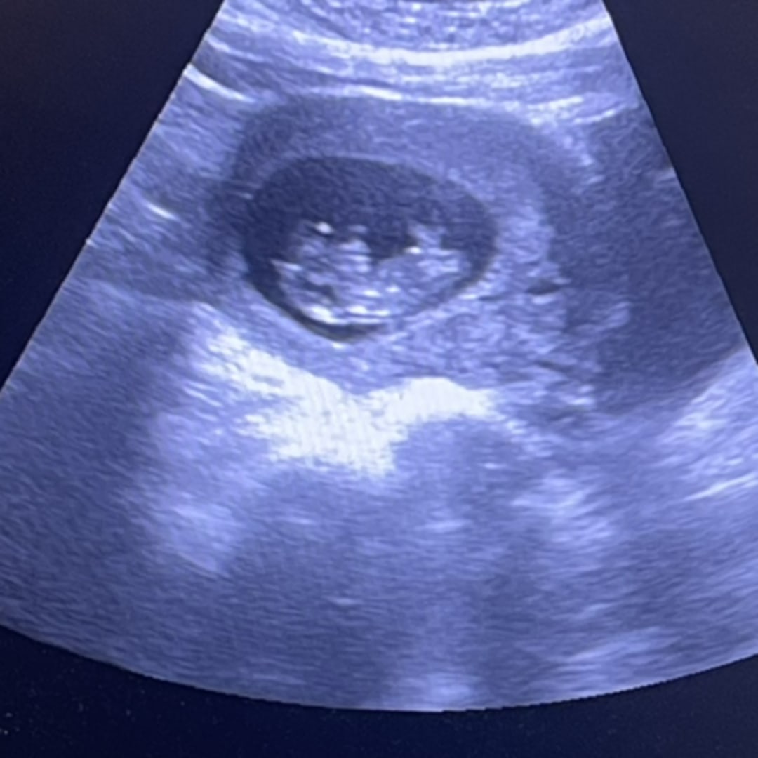 Photo shared by Karina for their Babylist baby registry.