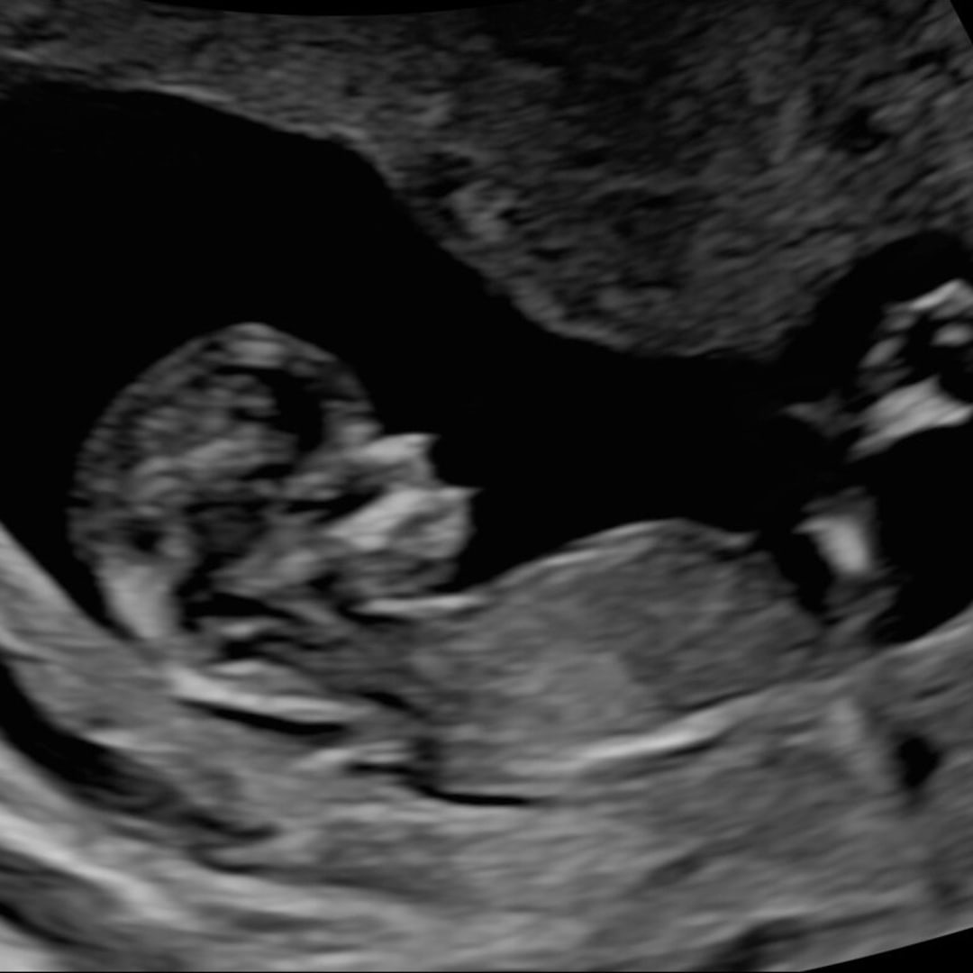 Photo shared by Michaela for their Babylist baby registry.