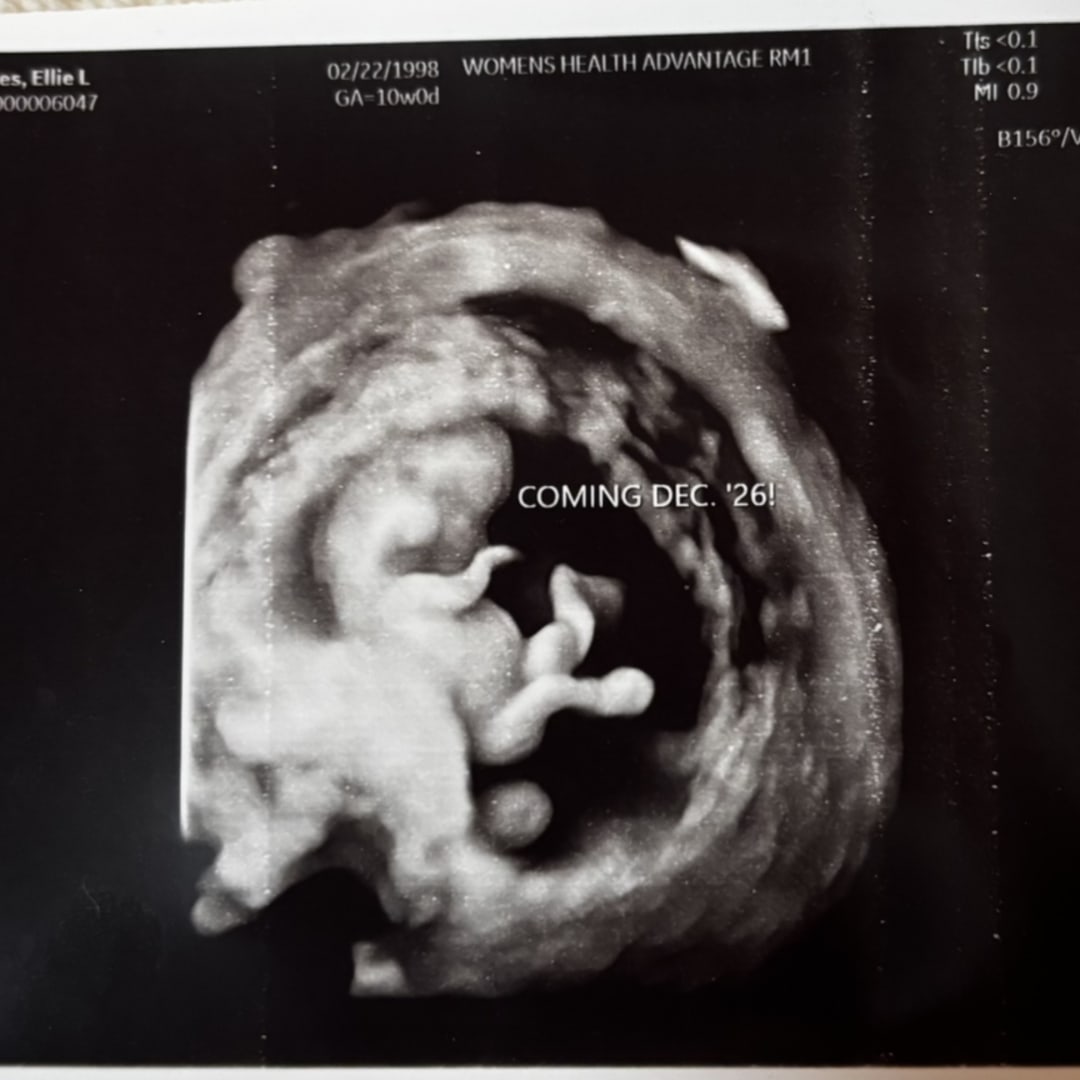 Photo shared by Ellie for their Babylist baby registry.