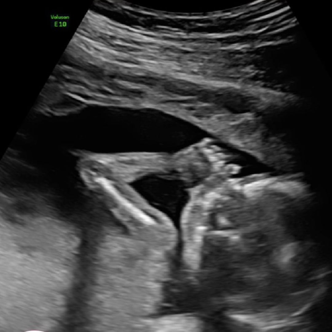 Photo shared by Allie for their Babylist baby registry.