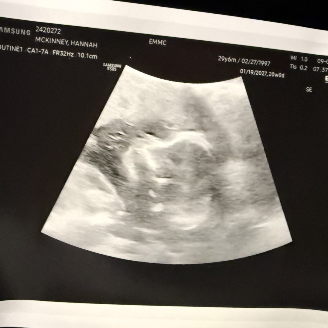 Photo shared by Hannah for their Babylist baby registry.