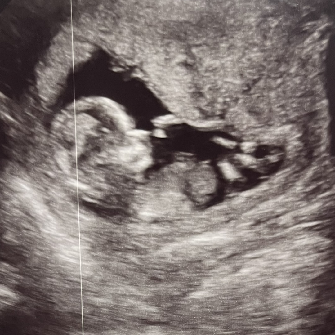 Photo shared by Trevon for their Babylist baby registry.