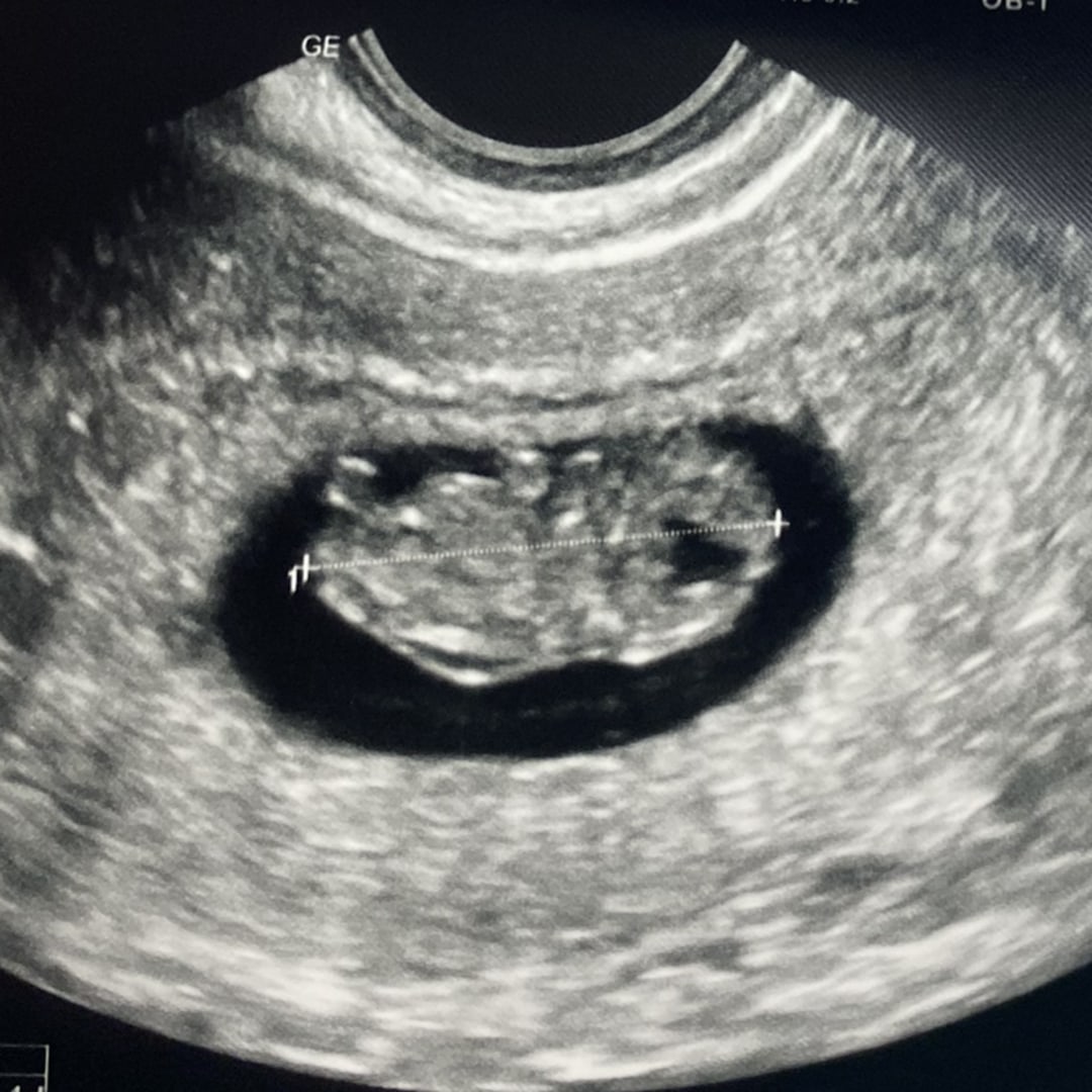 Photo shared by Autumn for their Babylist baby registry.