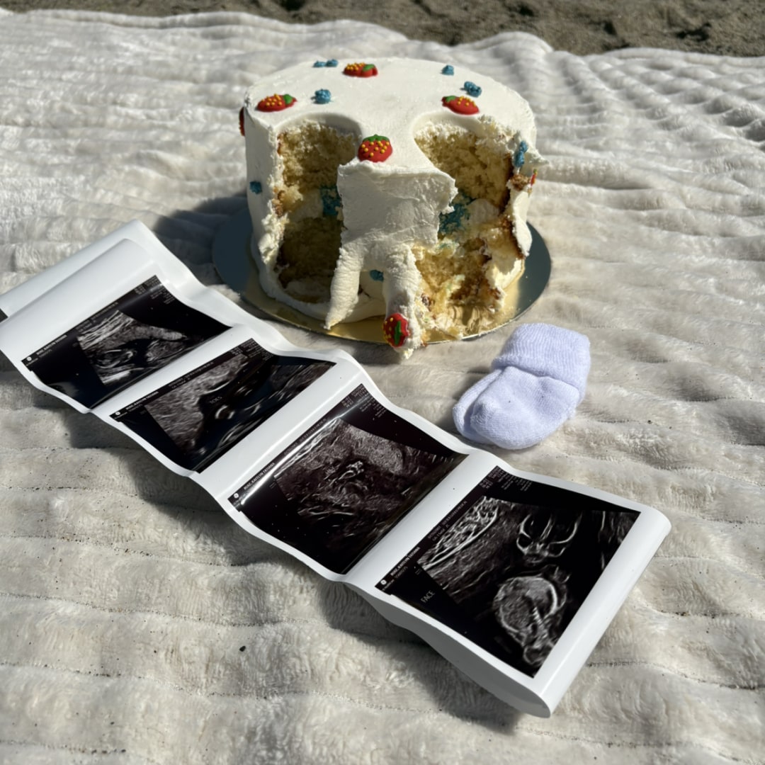 Photo shared by Kaitlyn for their Babylist baby registry.