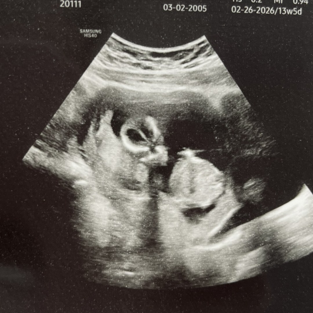Photo shared by Lea for their Babylist baby registry.