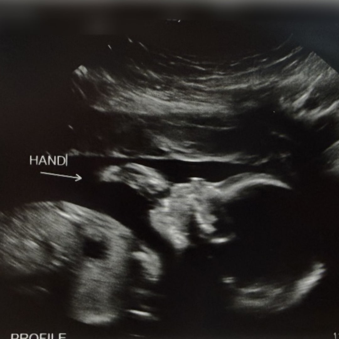 Photo shared by Lexi for their Babylist baby registry.